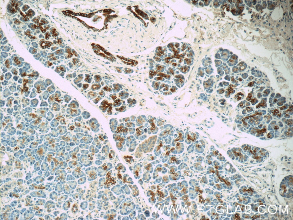 Immunohistochemistry (IHC) staining of human pancreas tissue using RIMS1-Specific Polyclonal antibody (20092-1-AP)