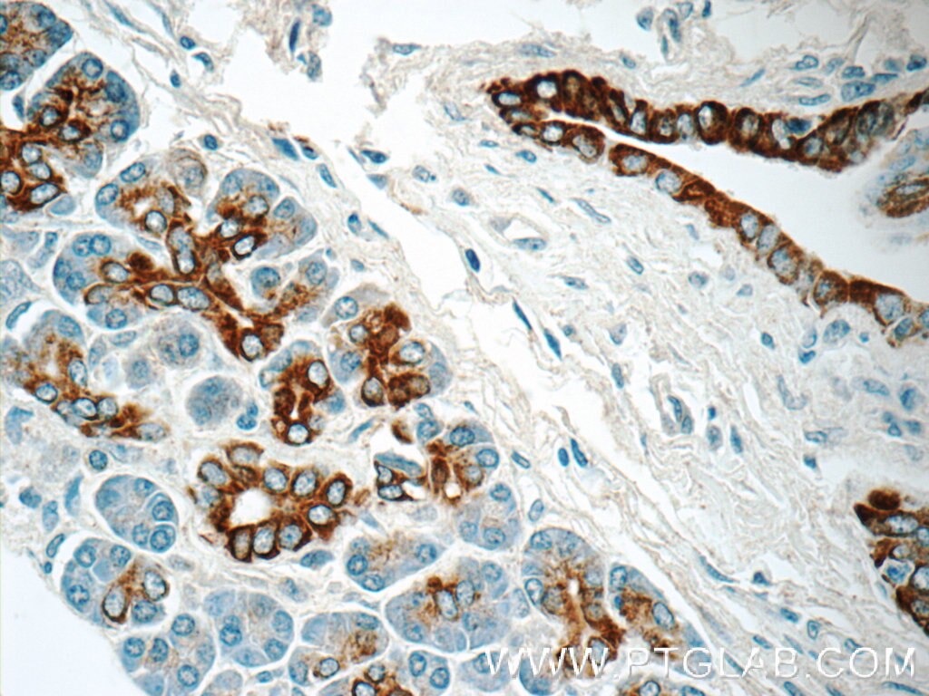 Immunohistochemistry (IHC) staining of human pancreas tissue using RIMS1-Specific Polyclonal antibody (20092-1-AP)