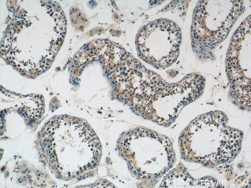 Immunohistochemistry (IHC) staining of human testis tissue using RIMS1-Specific Polyclonal antibody (20092-1-AP)