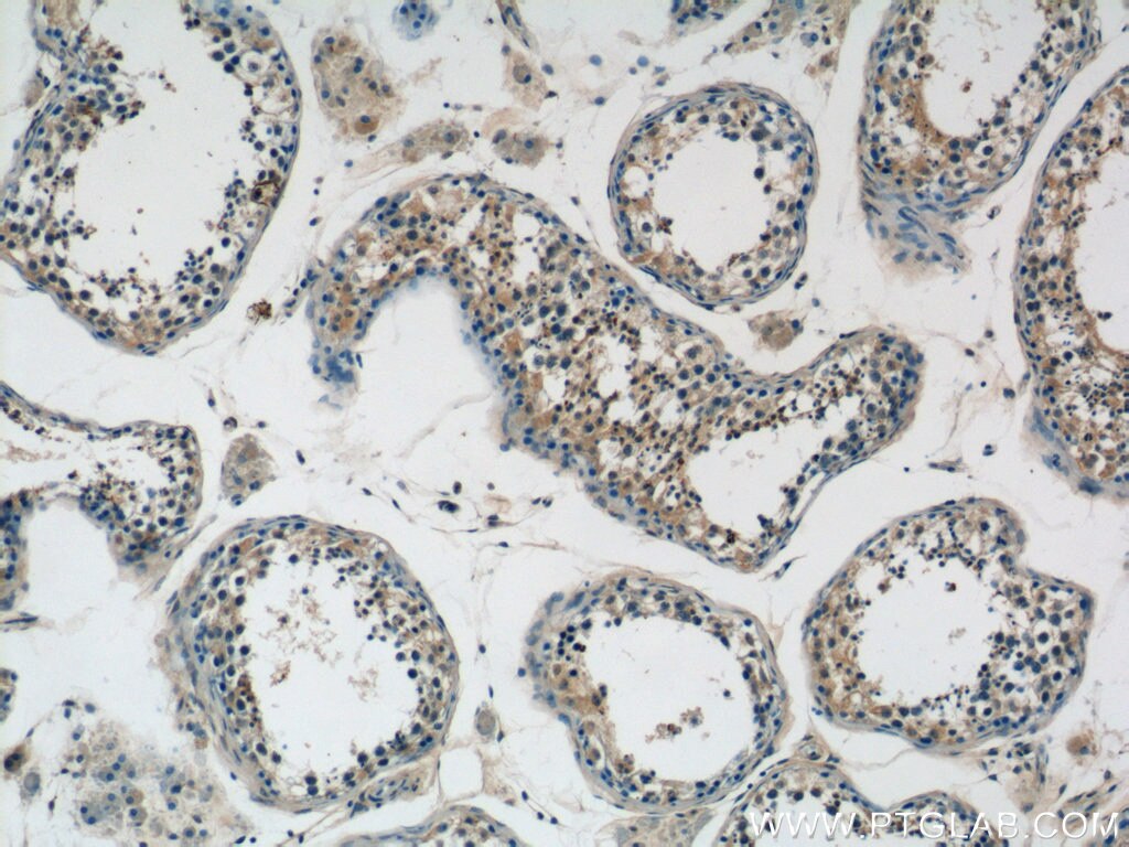 Immunohistochemistry (IHC) staining of human testis tissue using RIMS1-Specific Polyclonal antibody (20092-1-AP)