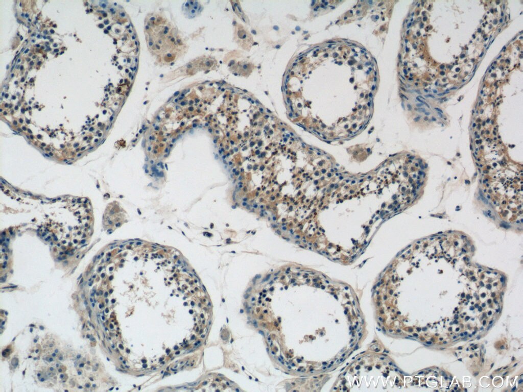 IHC staining of human testis using 20092-1-AP