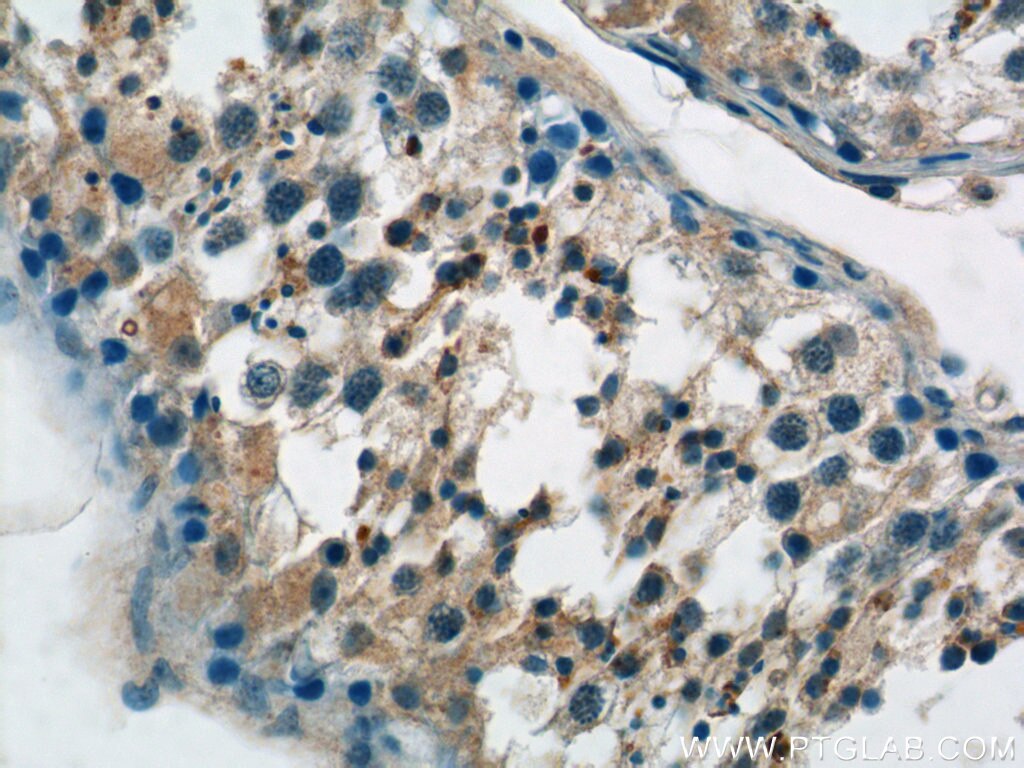 Immunohistochemistry (IHC) staining of human testis tissue using RIMS1-Specific Polyclonal antibody (20092-1-AP)