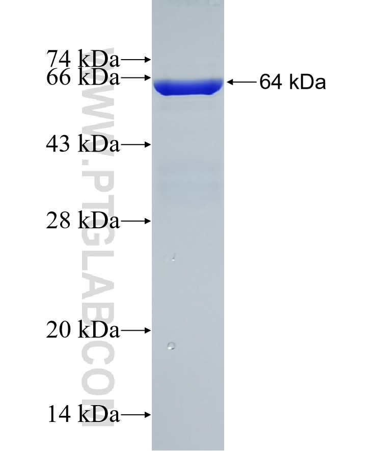 RIMS2 fusion protein Ag4806 SDS-PAGE