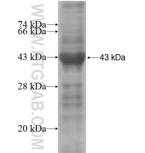 RIMS2 fusion protein Ag5018 SDS-PAGE