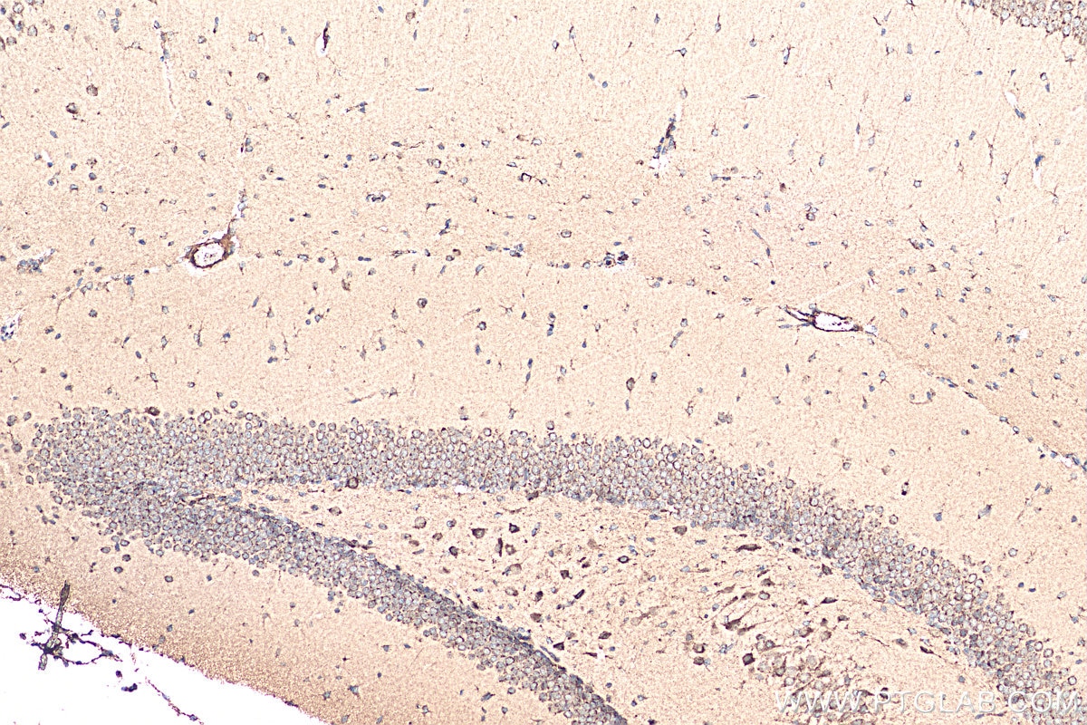 Immunohistochemistry (IHC) staining of mouse brain tissue using RIM2-Specific Polyclonal antibody (20093-1-AP)