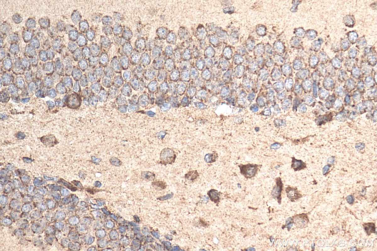 Immunohistochemistry (IHC) staining of mouse brain tissue using RIM2-Specific Polyclonal antibody (20093-1-AP)