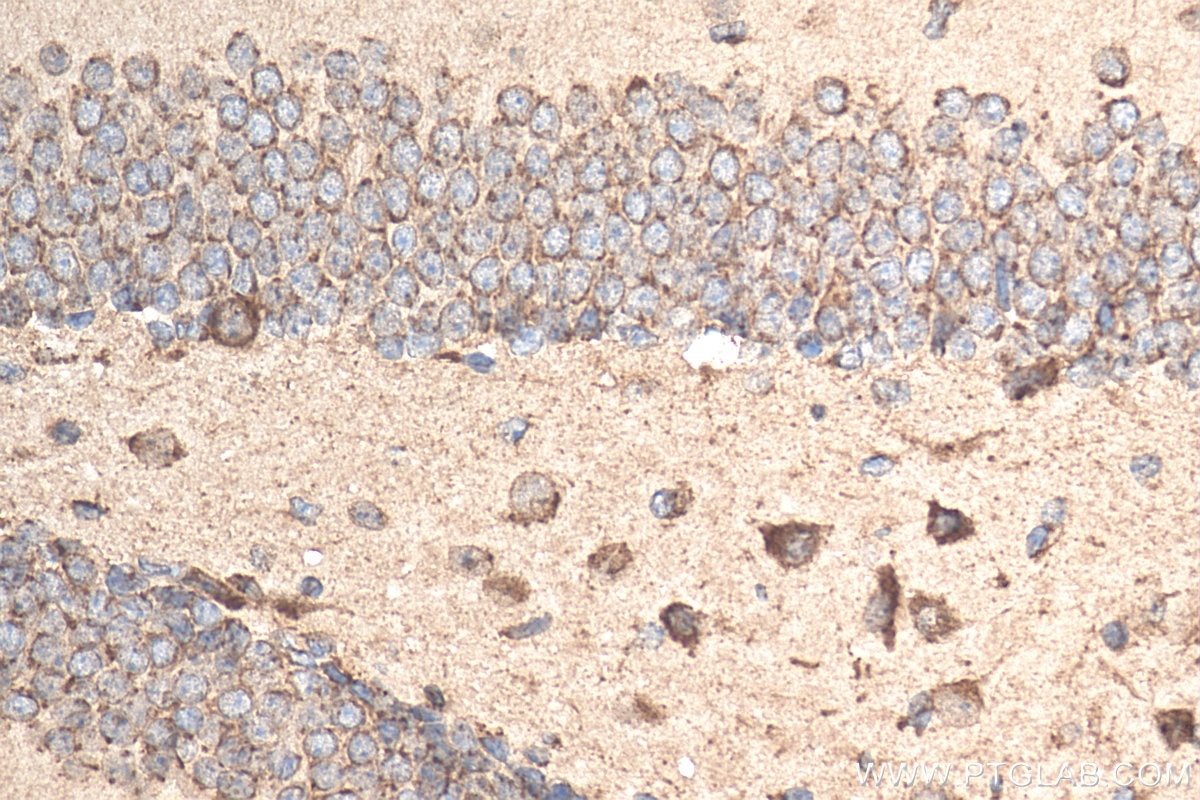 IHC staining of mouse brain using 20093-1-AP