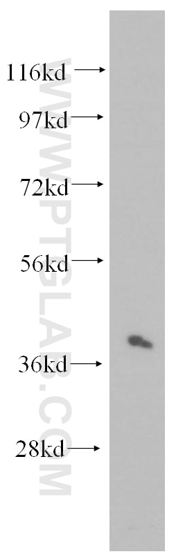 Western Blot (WB) analysis of HL-60 cells using RIMS3 Polyclonal antibody (15088-1-AP)