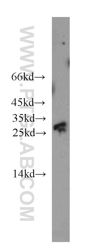 Western Blot (WB) analysis of mouse brain tissue using RIMS4-Specific Polyclonal antibody (20091-1-AP)