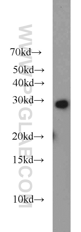 Western Blot (WB) analysis of mouse brain tissue using RIMS4-Specific Polyclonal antibody (20091-1-AP)