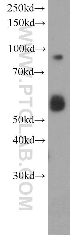 Western Blot (WB) analysis of HeLa cells using RIN1 Polyclonal antibody (16388-1-AP)