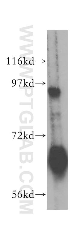 Western Blot (WB) analysis of HeLa cells using RIN1 Polyclonal antibody (16388-1-AP)