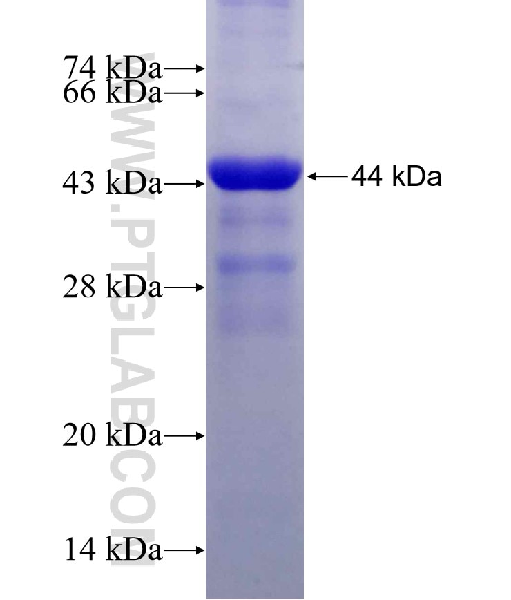 RIN1 fusion protein Ag29914 SDS-PAGE