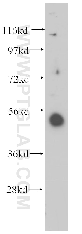 Western Blot (WB) analysis of BxPC-3 cells using RING1 Polyclonal antibody (15037-1-AP)