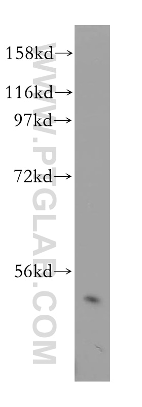 Western Blot (WB) analysis of PC-3 cells using RING1 Polyclonal antibody (15037-1-AP)