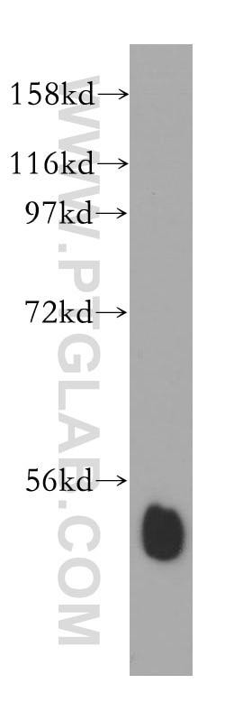 Western Blot (WB) analysis of mouse skeletal muscle tissue using RING1 Polyclonal antibody (15037-1-AP)