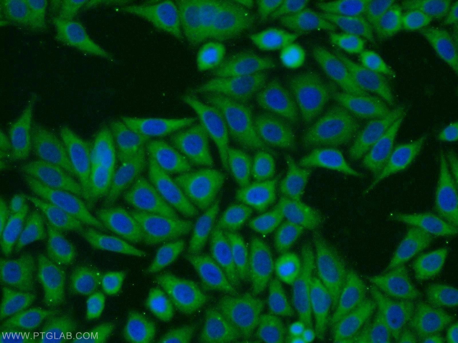 Immunofluorescence (IF) / fluorescent staining of HepG2 cells using RINT1 Polyclonal antibody (14567-1-AP)