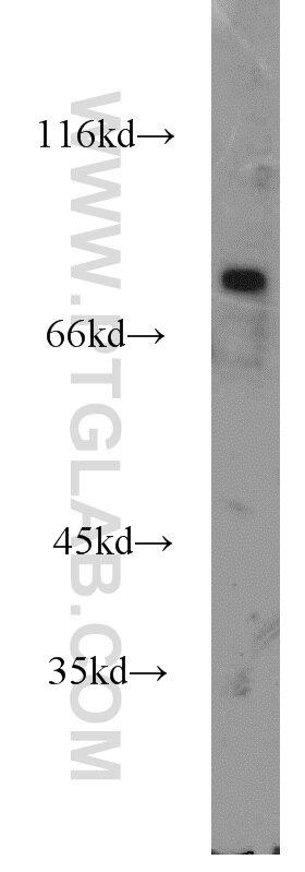 Western Blot (WB) analysis of HepG2 cells using RINT1 Polyclonal antibody (14567-1-AP)