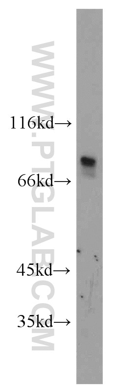 Western Blot (WB) analysis of HepG2 cells using RINT1 Polyclonal antibody (14567-1-AP)