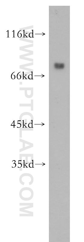 Western Blot (WB) analysis of HepG2 cells using RINT1 Polyclonal antibody (14567-1-AP)