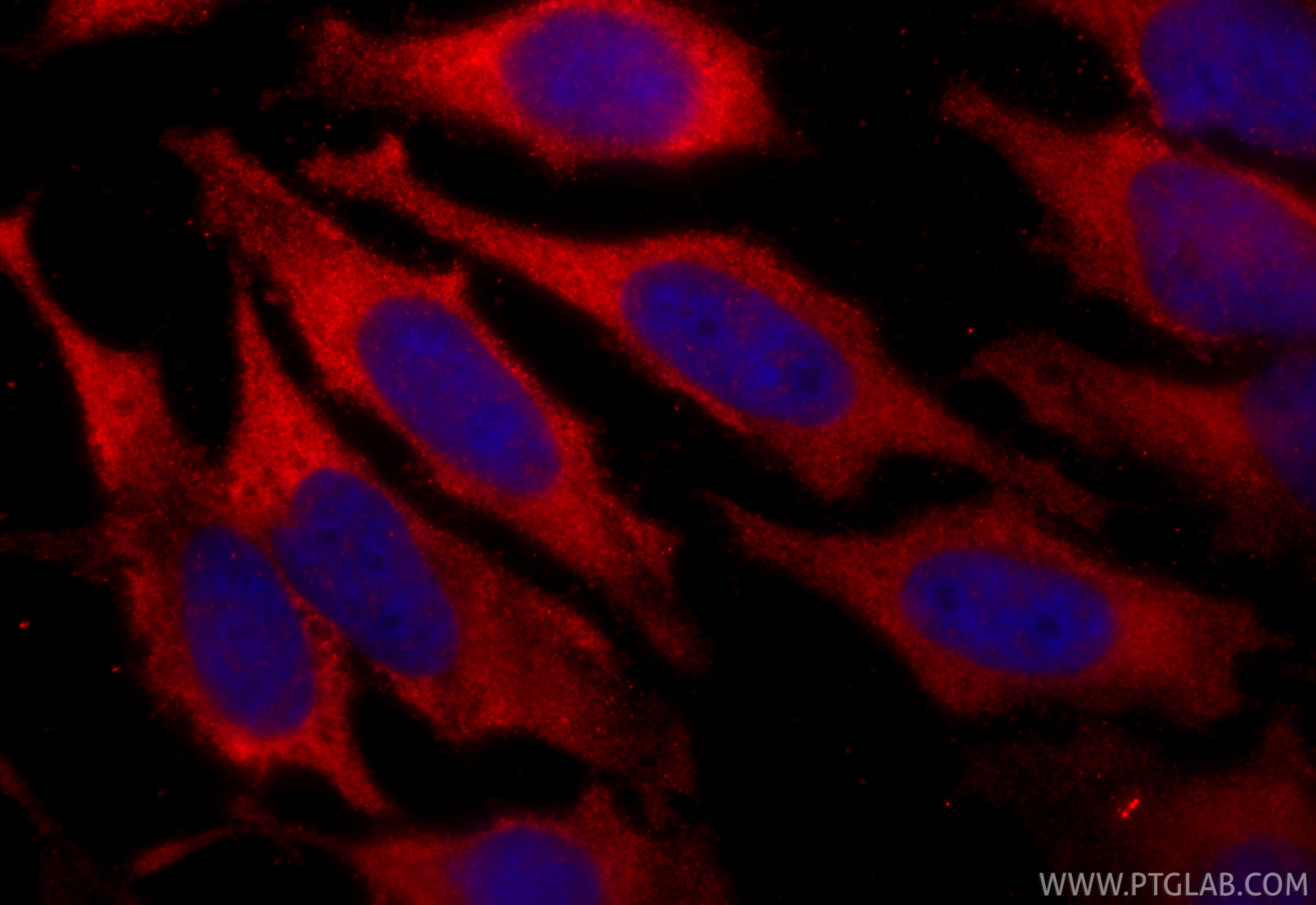 Immunofluorescence (IF) / fluorescent staining of HeLa cells using RIOK1 Polyclonal antibody (17222-1-AP)