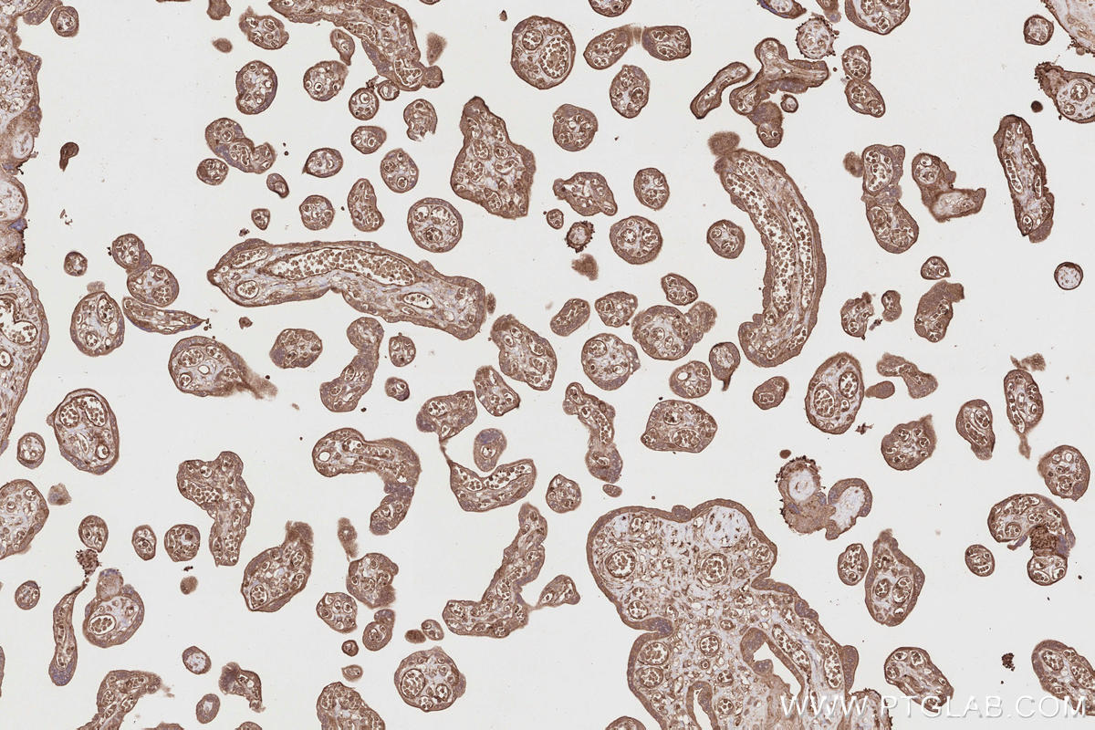 Immunohistochemistry (IHC) staining of human placenta tissue using RIOK1 Polyclonal antibody (17222-1-AP)