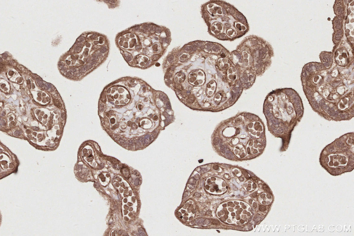 Immunohistochemistry (IHC) staining of human placenta tissue using RIOK1 Polyclonal antibody (17222-1-AP)