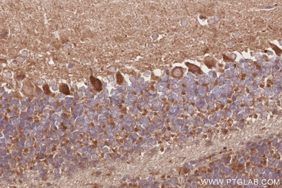 Immunohistochemistry (IHC) staining of mouse cerebellum tissue using RIOK1 Polyclonal antibody (17222-1-AP)