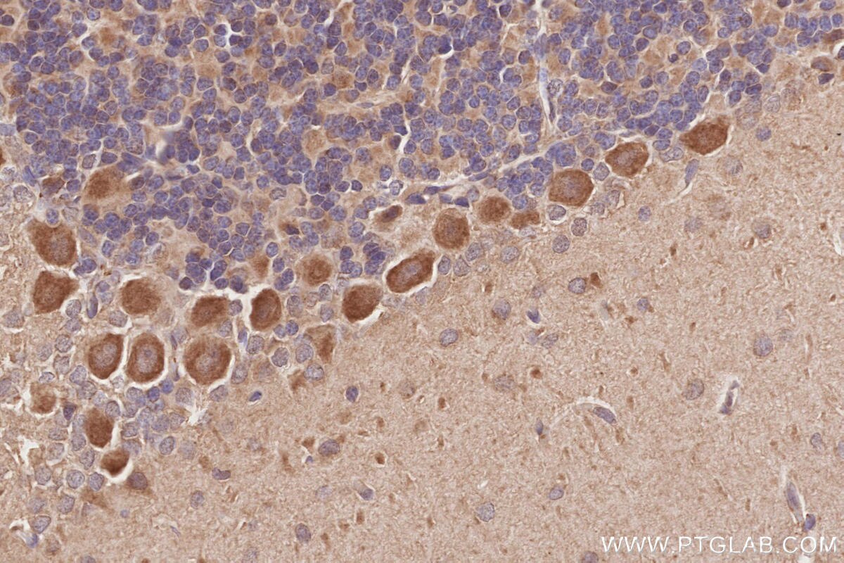 Immunohistochemistry (IHC) staining of rat cerebellum tissue using RIOK1 Polyclonal antibody (17222-1-AP)