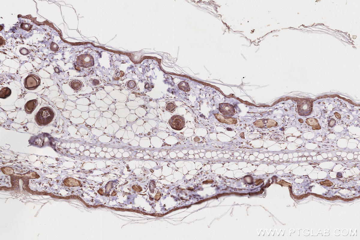 Immunohistochemistry (IHC) staining of rat skin tissue using RIOK1 Polyclonal antibody (17222-1-AP)