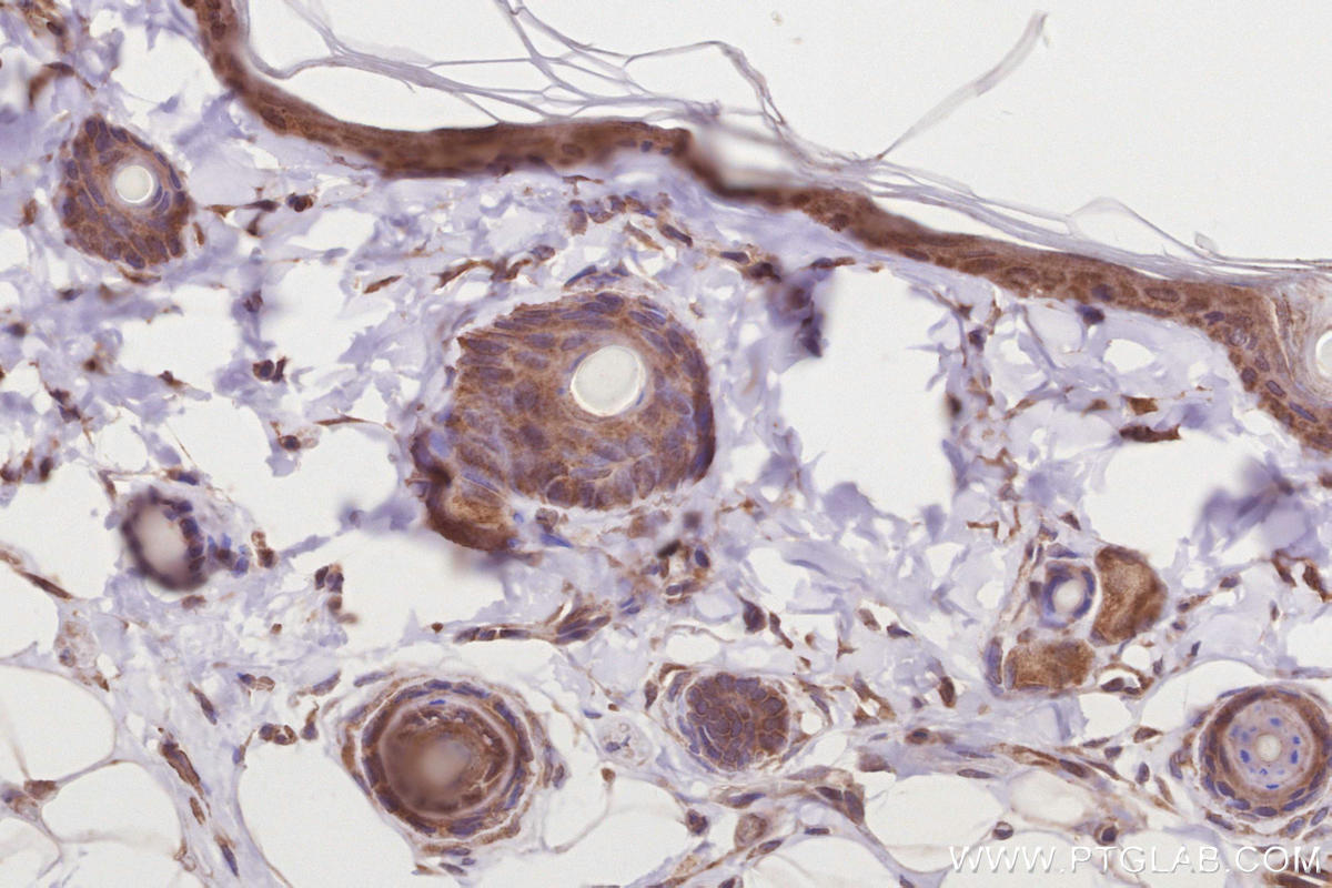 Immunohistochemistry (IHC) staining of rat skin tissue using RIOK1 Polyclonal antibody (17222-1-AP)