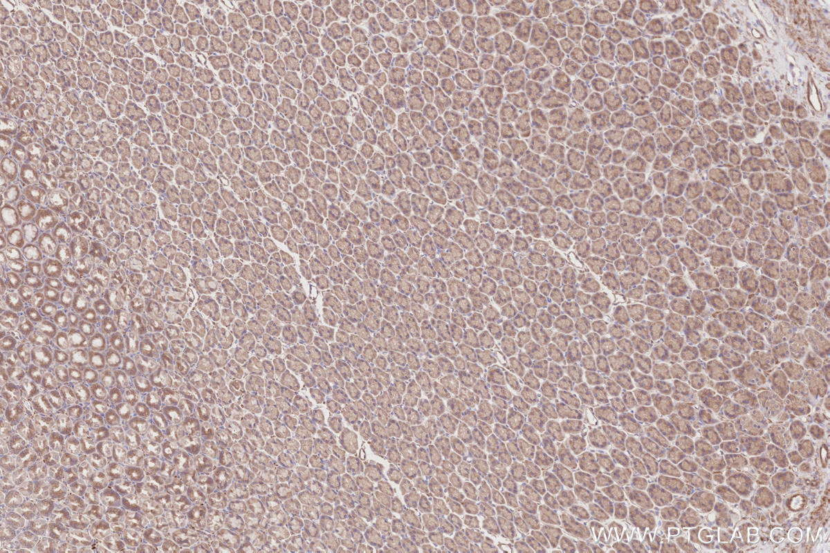 Immunohistochemistry (IHC) staining of rat stomach tissue using RIOK1 Polyclonal antibody (17222-1-AP)