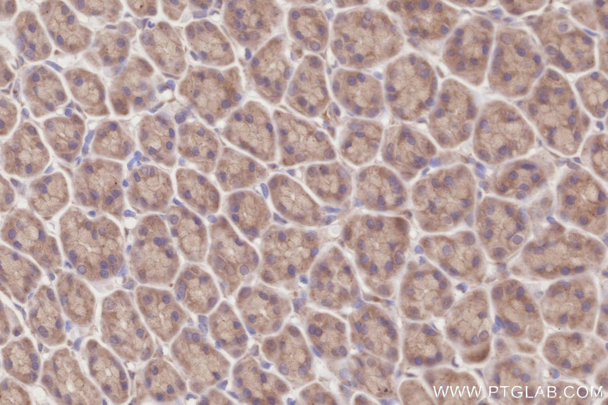 Immunohistochemistry (IHC) staining of rat stomach tissue using RIOK1 Polyclonal antibody (17222-1-AP)