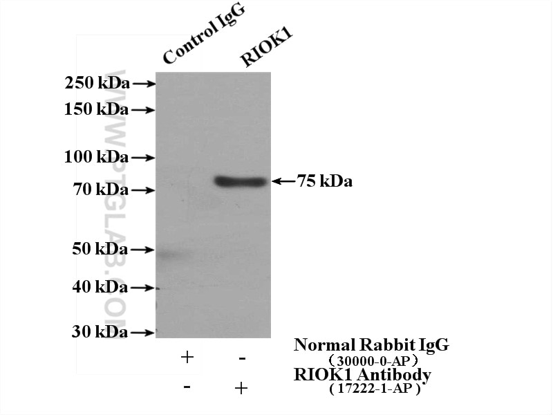 Immunoprecipitation (IP) experiment of HeLa cells using RIOK1 Polyclonal antibody (17222-1-AP)