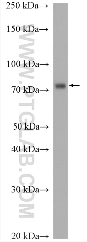 Western Blot (WB) analysis of HeLa cells using RIOK1 Polyclonal antibody (17222-1-AP)
