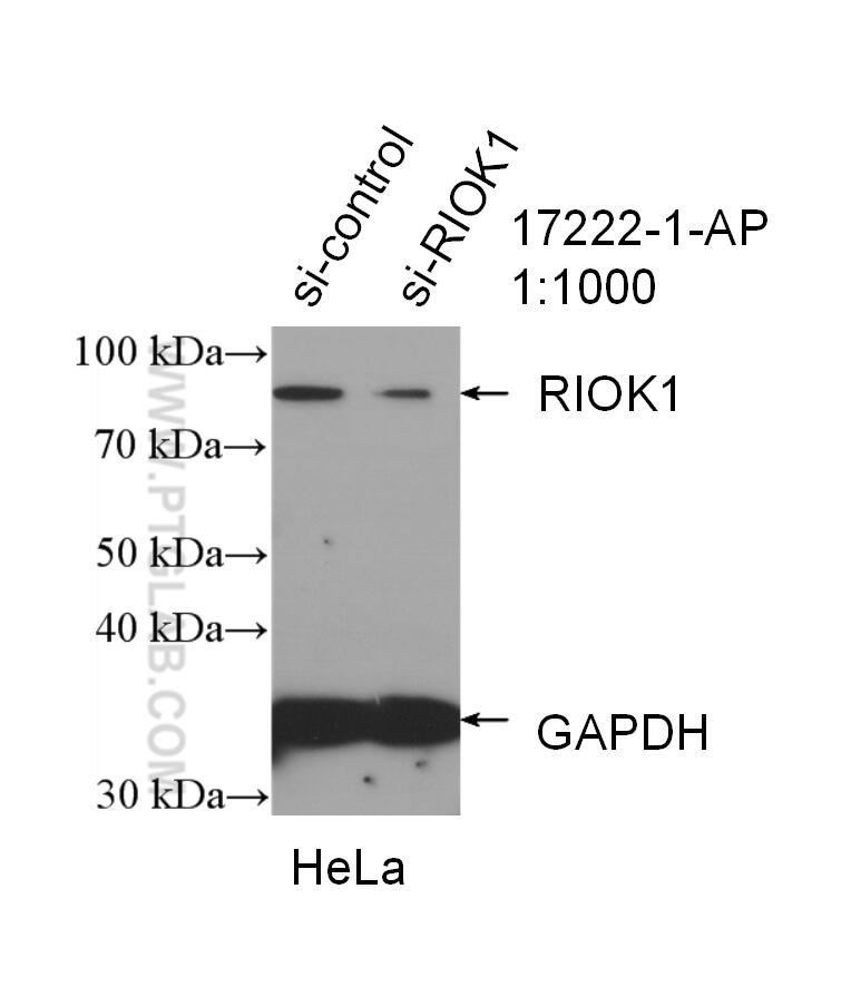 Western Blot (WB) analysis of HeLa cells using RIOK1 Polyclonal antibody (17222-1-AP)