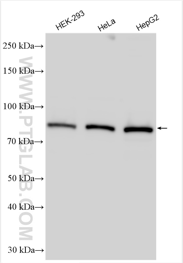 Western Blot (WB) analysis of various lysates using RIOK1 Polyclonal antibody (17222-1-AP)