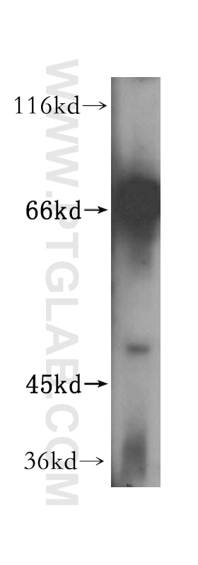 RIOK1