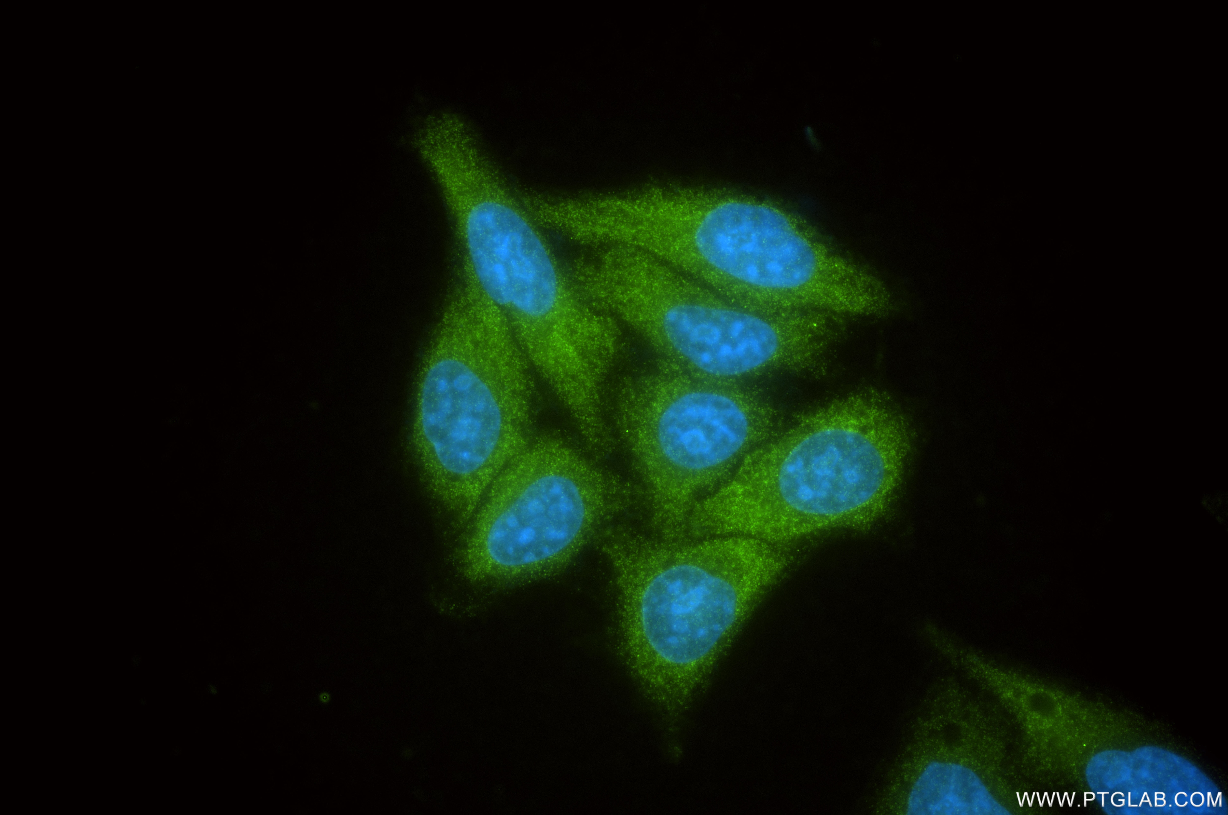Immunofluorescence (IF) / fluorescent staining of HepG2 cells using RIOK1 Recombinant monoclonal antibody (85668-5-RR)