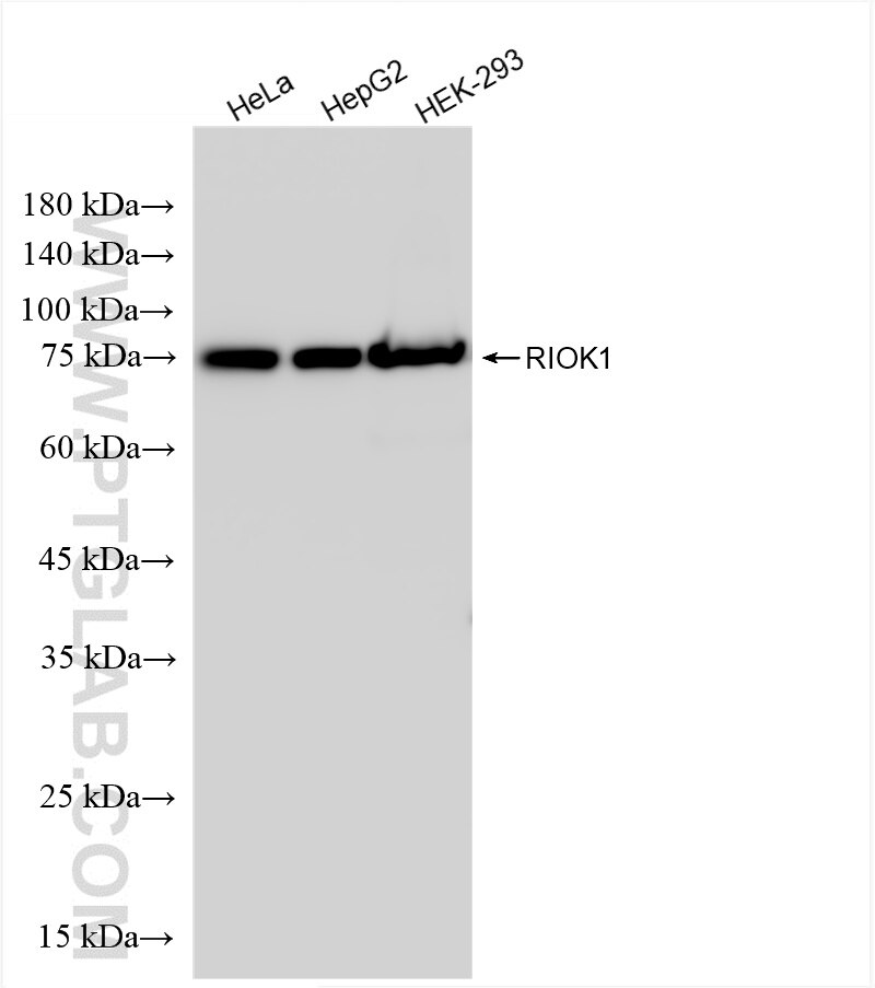 RIOK1