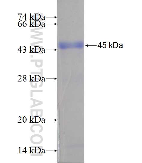 RIOK1 fusion protein Ag11128 SDS-PAGE
