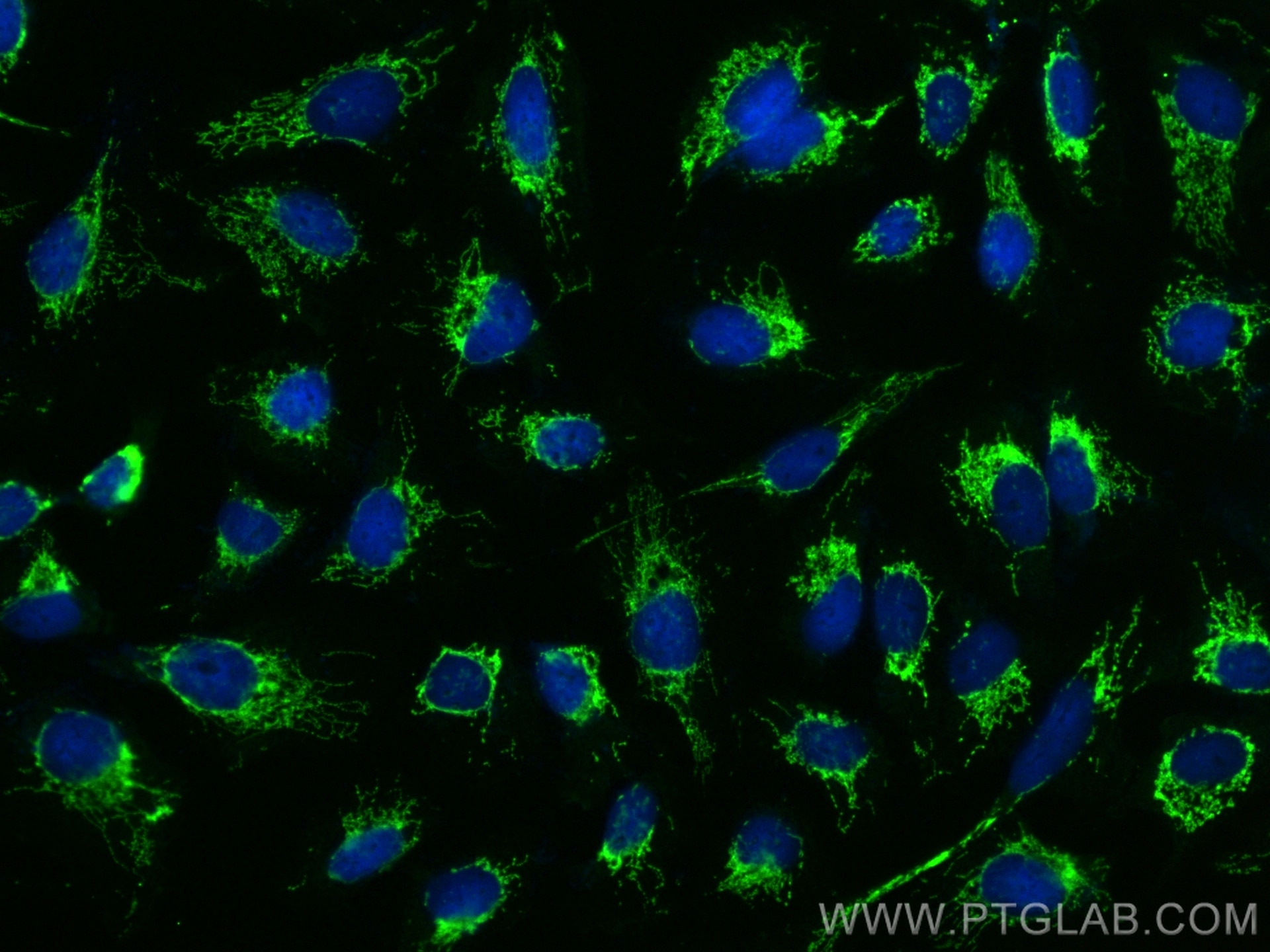 Immunofluorescence (IF) / fluorescent staining of U2OS cells using RIOK2 Polyclonal antibody (17410-1-AP)