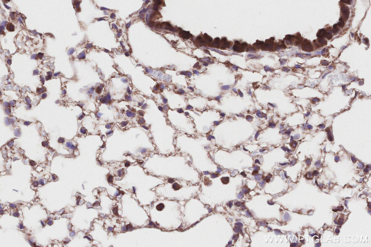 IHC staining of mouse lung using 17410-1-AP Immunohistochemistry (IHC) staining of mouse lung tissue using RIOK2 Polyclonal antibody (17410-1-AP)