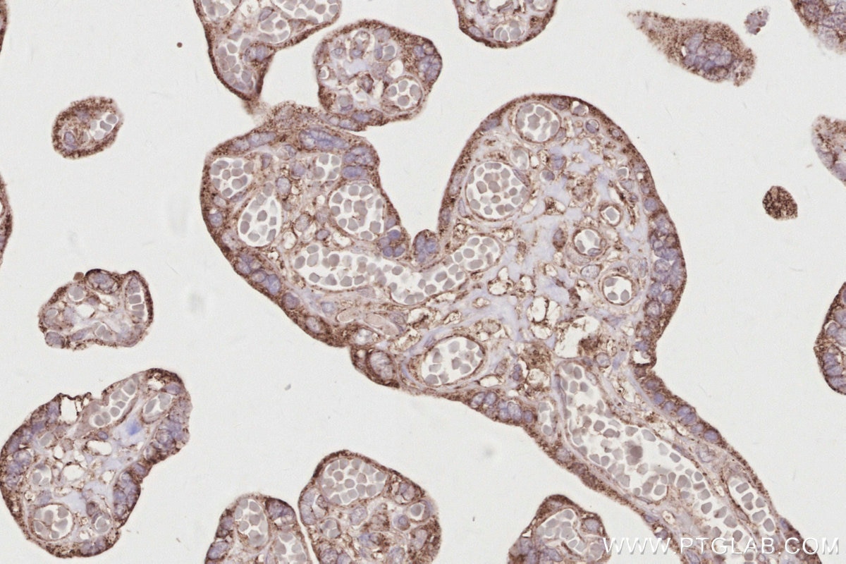 IHC staining of human placenta using 17410-1-AP Immunohistochemistry (IHC) staining of human placenta tissue using RIOK2 Polyclonal antibody (17410-1-AP)