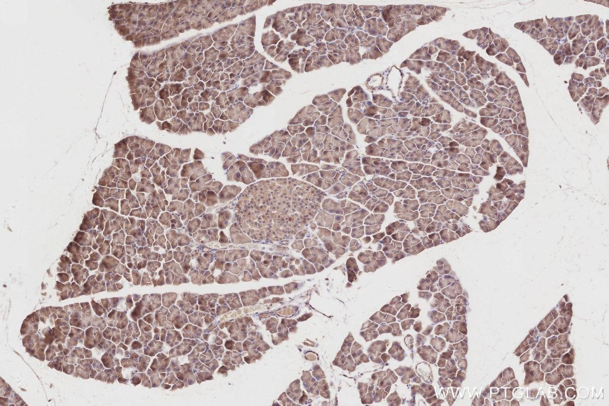 IHC staining of mouse pancreas using 17410-1-AP Immunohistochemistry (IHC) staining of mouse pancreas tissue using RIOK2 Polyclonal antibody (17410-1-AP)