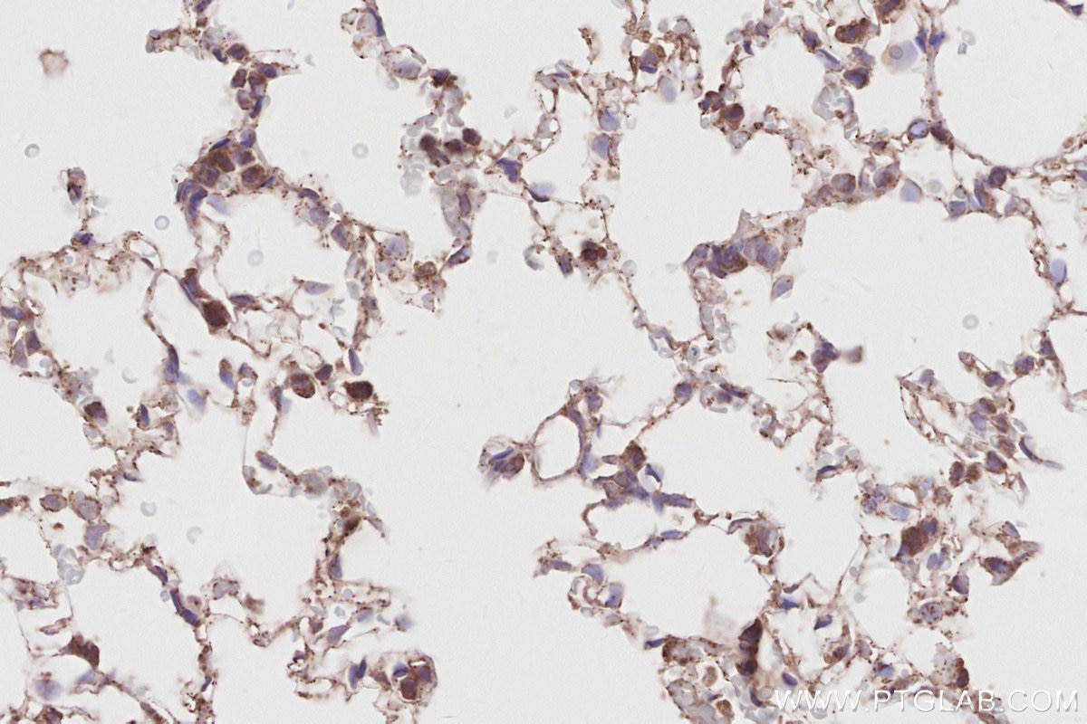 IHC staining of rat lung using 17410-1-AP Immunohistochemistry (IHC) staining of rat lung tissue using RIOK2 Polyclonal antibody (17410-1-AP)