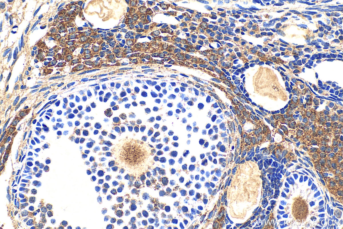 Immunohistochemistry (IHC) staining of mouse ovary tissue using RIOK2 Polyclonal antibody (17410-1-AP)