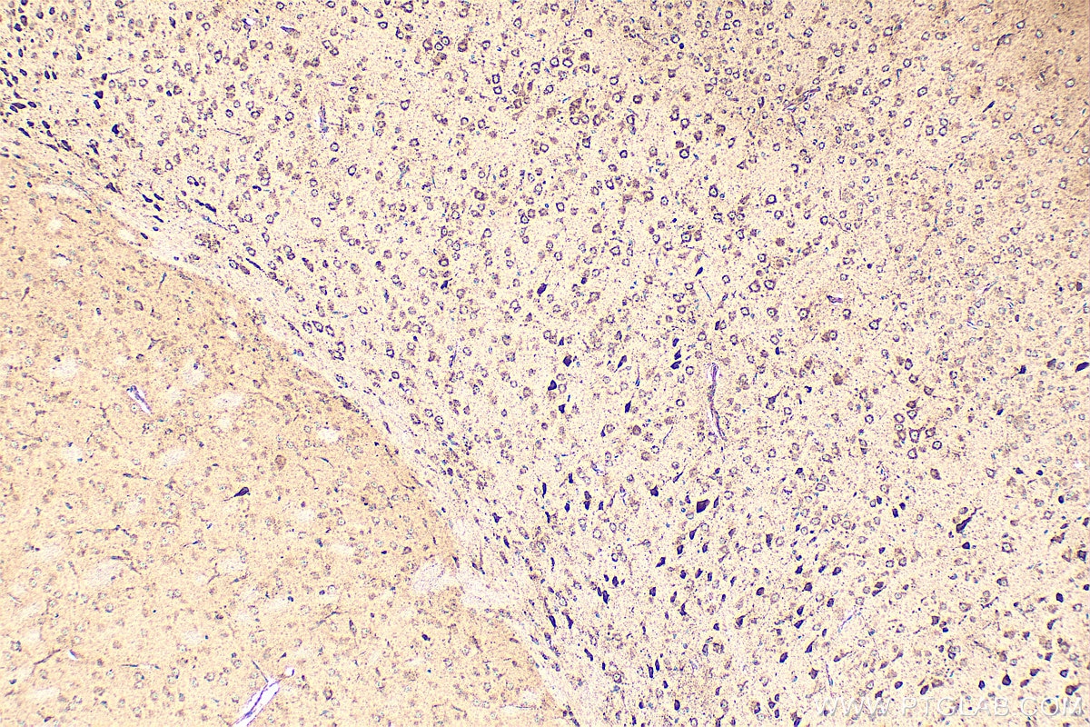 Immunohistochemistry (IHC) staining of mouse brain tissue using RIOK2 Polyclonal antibody (17410-1-AP)