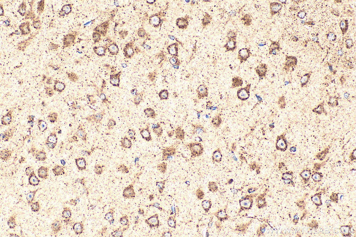 Immunohistochemistry (IHC) staining of mouse brain tissue using RIOK2 Polyclonal antibody (17410-1-AP)
