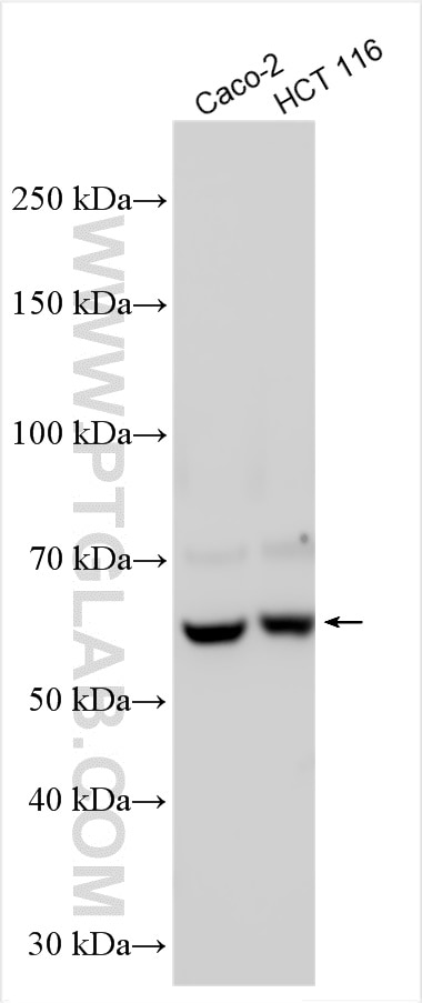 Western Blot (WB) analysis of various lysates using RIOK2 Polyclonal antibody (17410-1-AP)